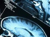 conmociones cerebrales pueden conducir desarrollo enfermedad Alzheimer