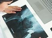 Preparación para cirugía reemplazo cadera recuperación