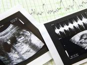 nuevo proyecto Ohio puede, impedir aborto bebé simplemente porque niño tiene cromosoma extra