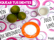 Cómo blanquear dientes