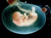Empeñados embrión persona