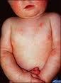 decálogo dermatitis
