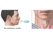 Cáncer tiroides tratamiento Yodo I-131