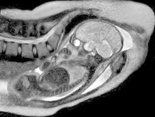 Resonancia magnética bebé momento nacer