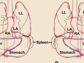 Situs Inversus