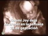 Bebé libra aborto pelos