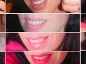 Sonrisas labiales...¿cuál tuyo?