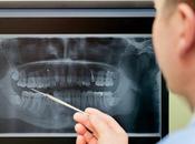 ¿Por puede necesitar operación sinusal quiere implantes dentales?
