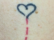 Neuman: Dejándose piel