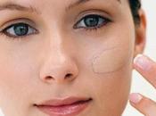 Consejos para maquillar piel grasa espinillas acné