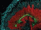 Descubierta proteína vincula virus zika microcefalia