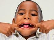 Lengua vellosa, lengua geográfica, otras malformaciones común