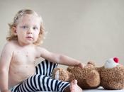 Consejos para evitar niños rasquen cuando tienen varicela