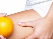 Cinco datos desconocías celulitis
