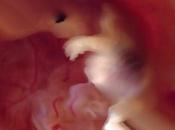 Sueños maternidad