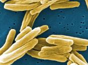 Encuentran Nueva Transmision Tuberculosis