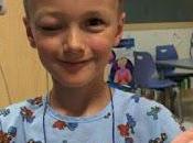 Diagosticado cáncer niño donaba cabello padecían