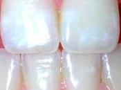 faltan dientes permanentes? ocurre hacer respecto