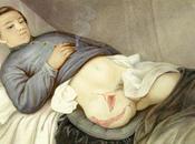 ¿Los amputados necesitan comer menos?