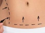 Abdominoplastia riesgos complicaciones