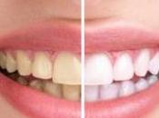 Cromogénicos causa manchas dientes: Causas soluciones