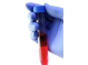 Tratamiento para cuando sangre orina –