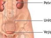 Tratamiento para cuando sangre orina –