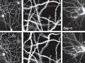 Nueva técnica para observar neuronas continuamente