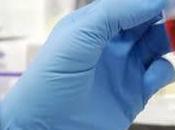 Biopsia líquida: método invasivo, rápido sencillo ¿cuándo estará disponible?