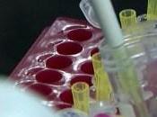 CNN: investigadores cubanos luchan contra cáncer pulmón vacuna