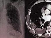 Proyecto 2.0: preguntas Anestesia críticos