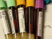 Curiosidades sobre anemia ferropenica