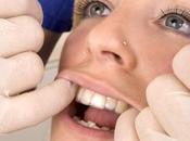 ¿Por dientes vuelven torcerse después tratamiento ortodóncico? ¿Cómo puede prevenido?