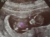 Embarazo: Actualización Septiembre Octubre