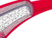 creado vasos sanguíneos