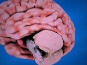 hipo durante tres semanas reveló metástasis cerebro