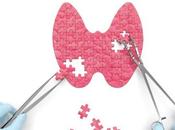 ¿Qué tiroidectomía realiza?