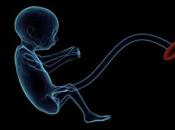 Bebé Utero ¿Qué Aquello Aborta?