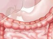 Úlcera duodenal