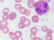 Eosinófilos altos