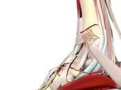 Tendinitis peroneal