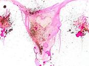 Tratar endometriosis cambios estilo vida: ¿ejercer ayuda endometriosis?