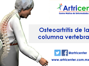 Osteoartritis columna vertebral