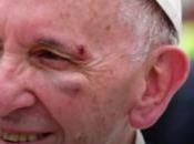 Papa Francisco Sufre Accidente Colombia Movil (VIDEO)