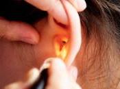 Preguntas para ensayo sobre sordera funcionarios EEUU