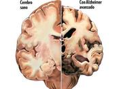 puede prevenir naturalmente alzhéimer?