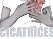 Cicatrices Ángel Zero