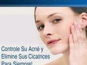 Remedios Homeopaticos Para Acne Mejor Solución Pueda Encontrar