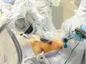 Realizan primera cirugía robótica tórax hospital público edoméx