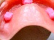 importancia crema fijadora dentaduras